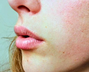Detailed close-up of a woman's facial skin showing natural texture and complexion.